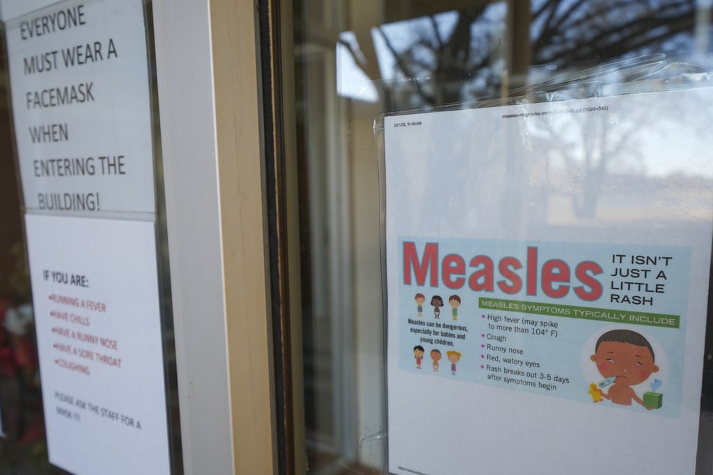 A Texas child who was not vaccinated has died of measles, a first for the US in a decade